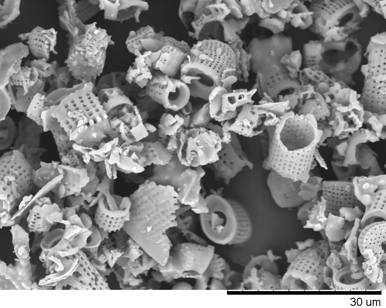 diatomaceous earth magnified